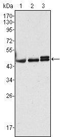 CK17 Antibody