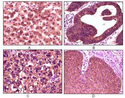 CK1 Antibody
