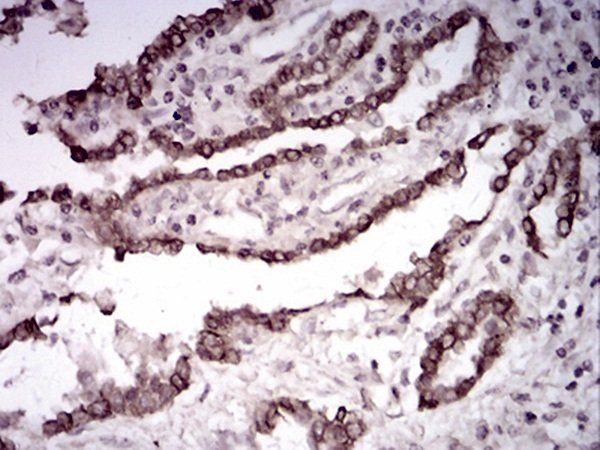 CK5 Antibody