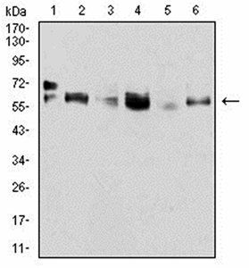 CK5 Antibody