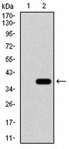 CK5 Antibody