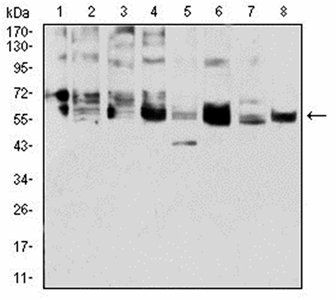 CK5 Antibody