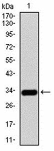 CK5 Antibody