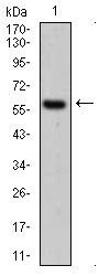 CK5 Antibody