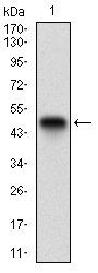 CK5 Antibody