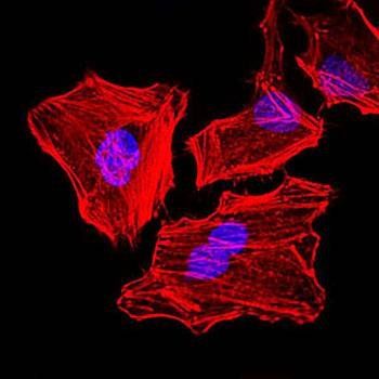 CK5 Antibody