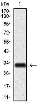 CK5 Antibody
