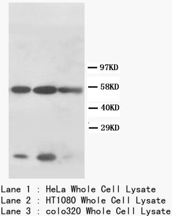 Anti-Cytokeratin 8/KRT8 Antibody