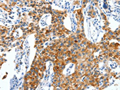 CKAP4 Antibody