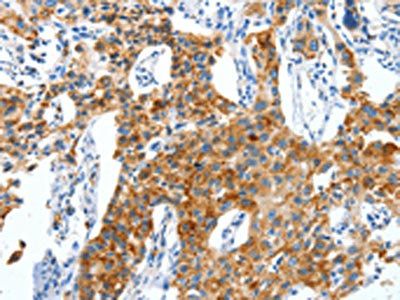 CKAP4 antibody