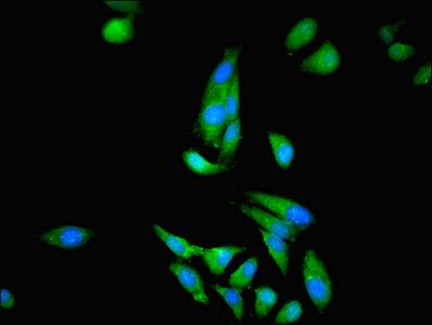 CKB Antibody
