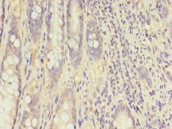 CKB Antibody
