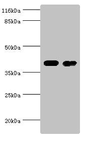 CKB antibody