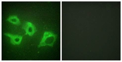 CKI-α Antibody