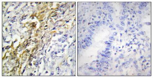 CKI-α Antibody