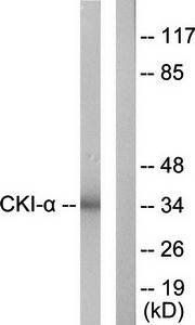 CKI-α Antibody