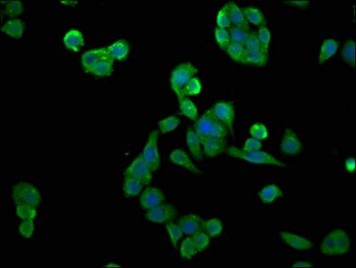 CSNK2A2 Antibody