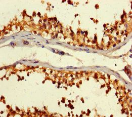 CSNK2A2 Antibody