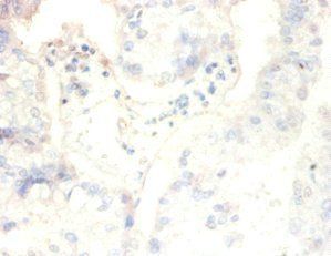 CSNK2B Antibody