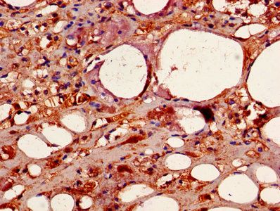 CSNK2B Antibody