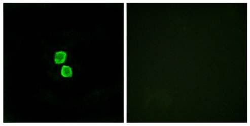 CKLFSF1 Antibody