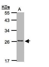 IL1F9 Rabbit Polyclonal Antibody