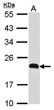 CKLFSF5 Rabbit Polyclonal Antibody