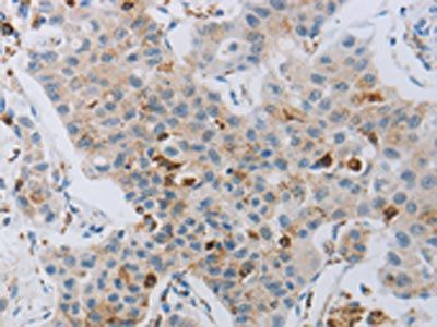 CKMT1A Antibody