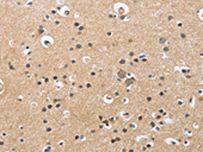 CKMT2 Antibody