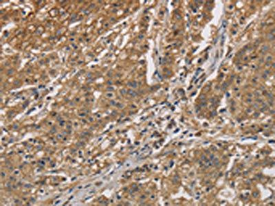 CKMT2 Antibody