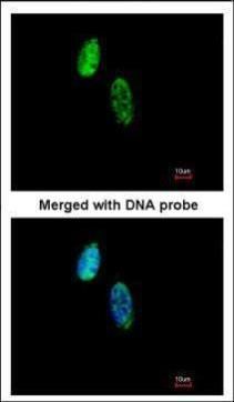 CKS2 antibody [N2C3]