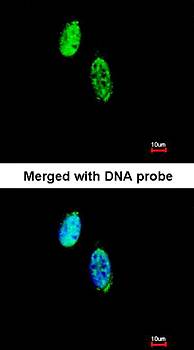 CKS-2 Rabbit Polyclonal Antibody