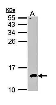 CKS-2 Rabbit Polyclonal Antibody