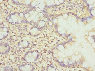 CLASP1 Antibody