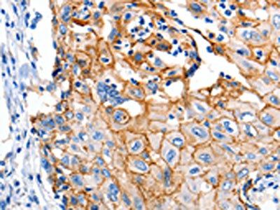 CLDN1 Antibody