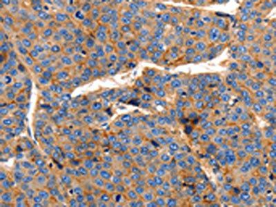 CLDN1 Antibody