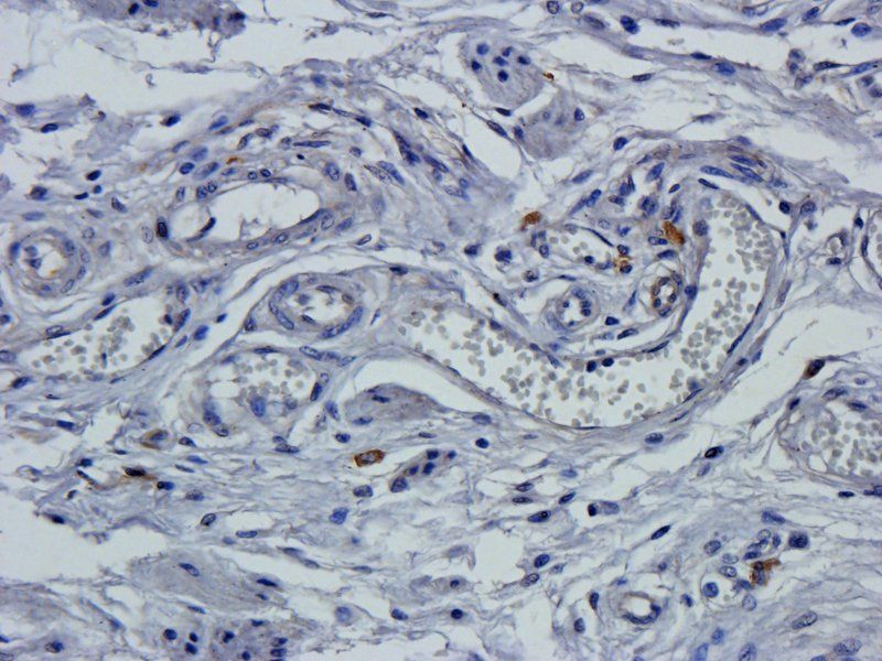 Claudin 1 antibody