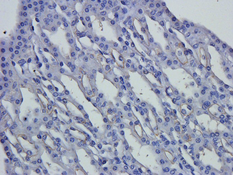 Claudin 1 antibody