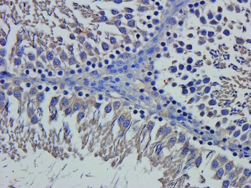 Claudin 1 antibody