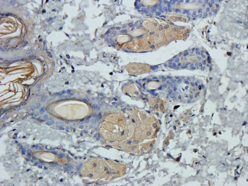 Claudin 1 antibody