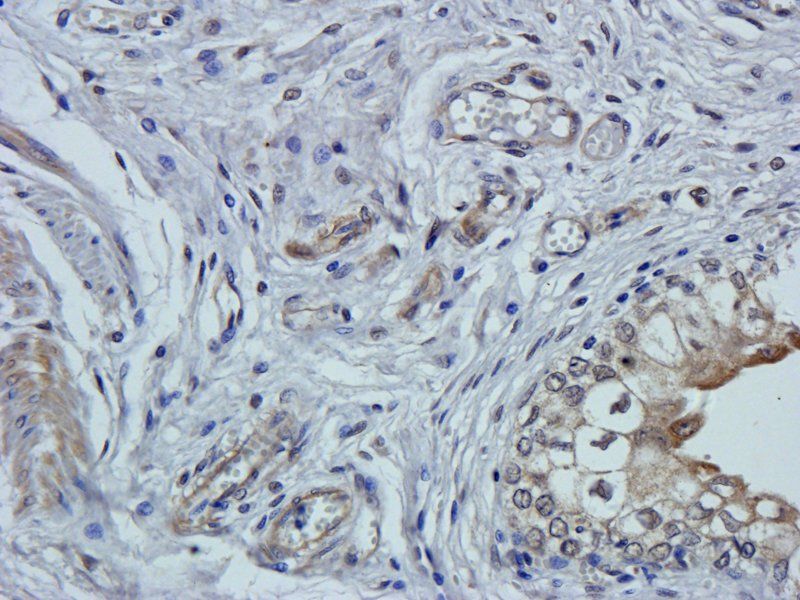 Claudin 1 antibody