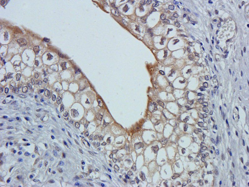 Claudin 1 antibody