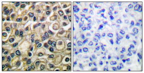 Claudin 1 Antibody