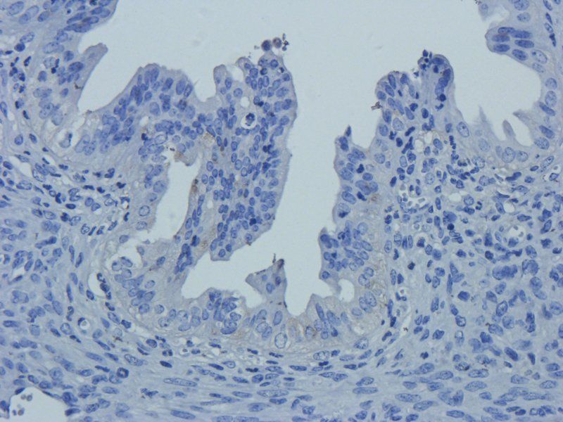 Claudin 5 antibody