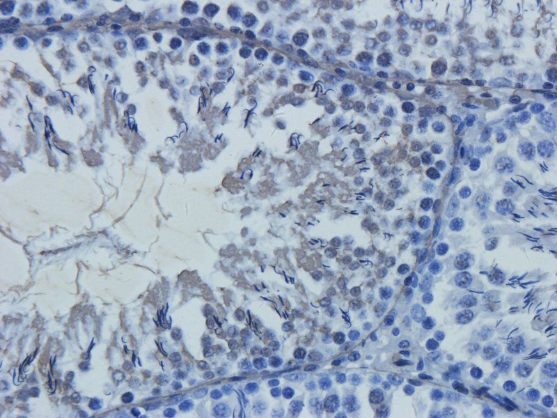 Claudin 5 antibody