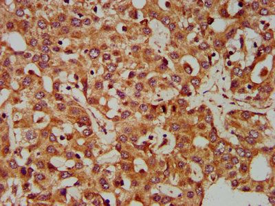 CLCC1 Antibody