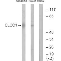 CLCC1 Antibody