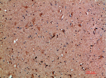 CLCF1 Antibody