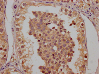 CLCN6 Antibody
