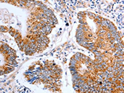 CLDN10 antibody